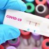 Yuk, Pahami Seluk Beluk Rapid Test di Sini!